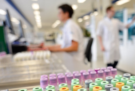 NVWA stelt in lab vast dat fruittelers te vroeg spuiten