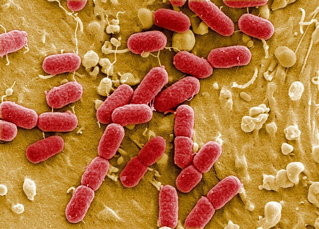 Ehec-bacterie onder de microscoop. - foto: ANP